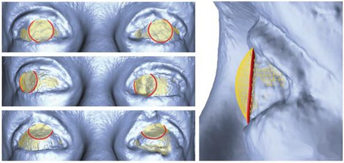 3D打印新技術(shù) 迪斯尼用照片重建繪制3D眼部立體圖_e鍵3D打印服務(wù)