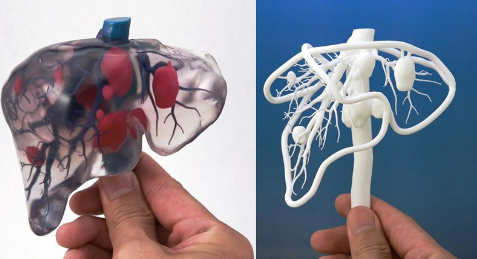 簡(jiǎn)述現(xiàn)階段醫(yī)用3D打印設(shè)備和打印材料的相關(guān)進(jìn)展_e鍵3D打印服務(wù) 簡(jiǎn)述現(xiàn)階段醫(yī)用3D打印設(shè)備和打印材料的相關(guān)進(jìn)展_e鍵3D打印服務(wù)