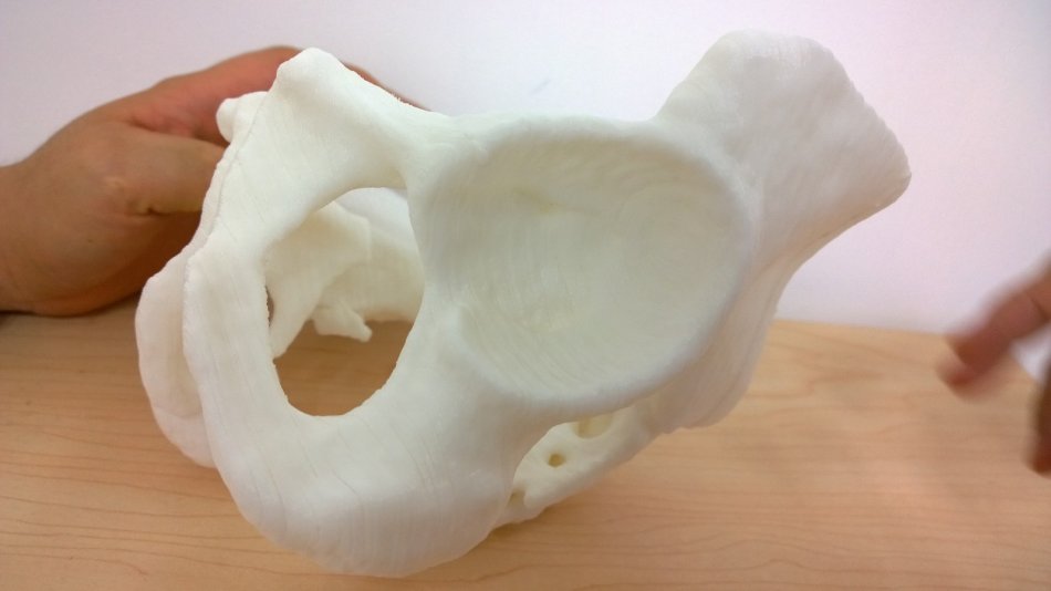 3d打印應用領域之醫(yī)療應用_e鍵打印服務公司