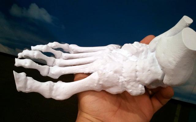 3d打印應用領域之醫(yī)療應用_e鍵打印服務公司