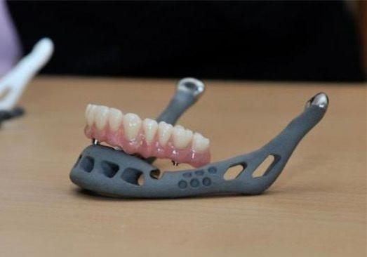 醫療3D打印的假牙 新手選擇3D打印手板模型加工打樣還是CNC加工?選擇當地還是全國3D打印公司? 醫療3D打印的假牙 新手選擇3D打印手板模型加工打樣還是CNC加工?選擇當地還是全國3D打印公司?