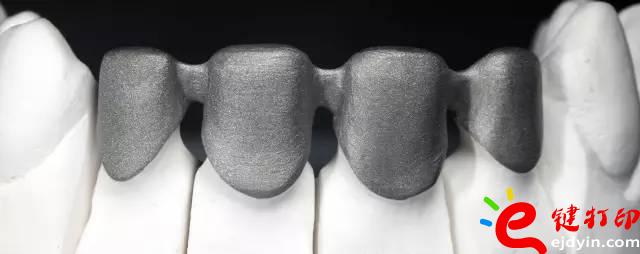 醫療輔助器械的變革之路 3d打印義齒(假牙)前景無限 勢在必行_醫療設備器械3d模型打印平臺 醫療輔助器械的變革之路 3d打印義齒(假牙)前景無限 勢在必行_醫療設備器械3d模型打印平臺