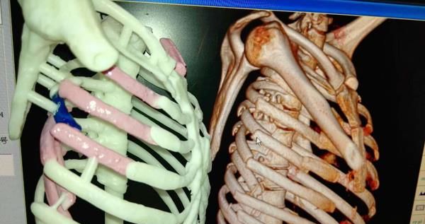 3d打印應用領域