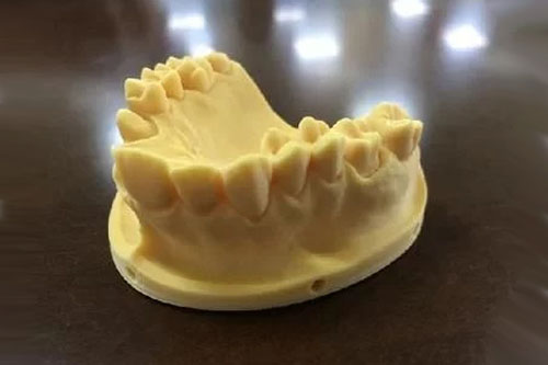 口腔齒科牙科領(lǐng)域的3D打印應(yīng)用現(xiàn)狀